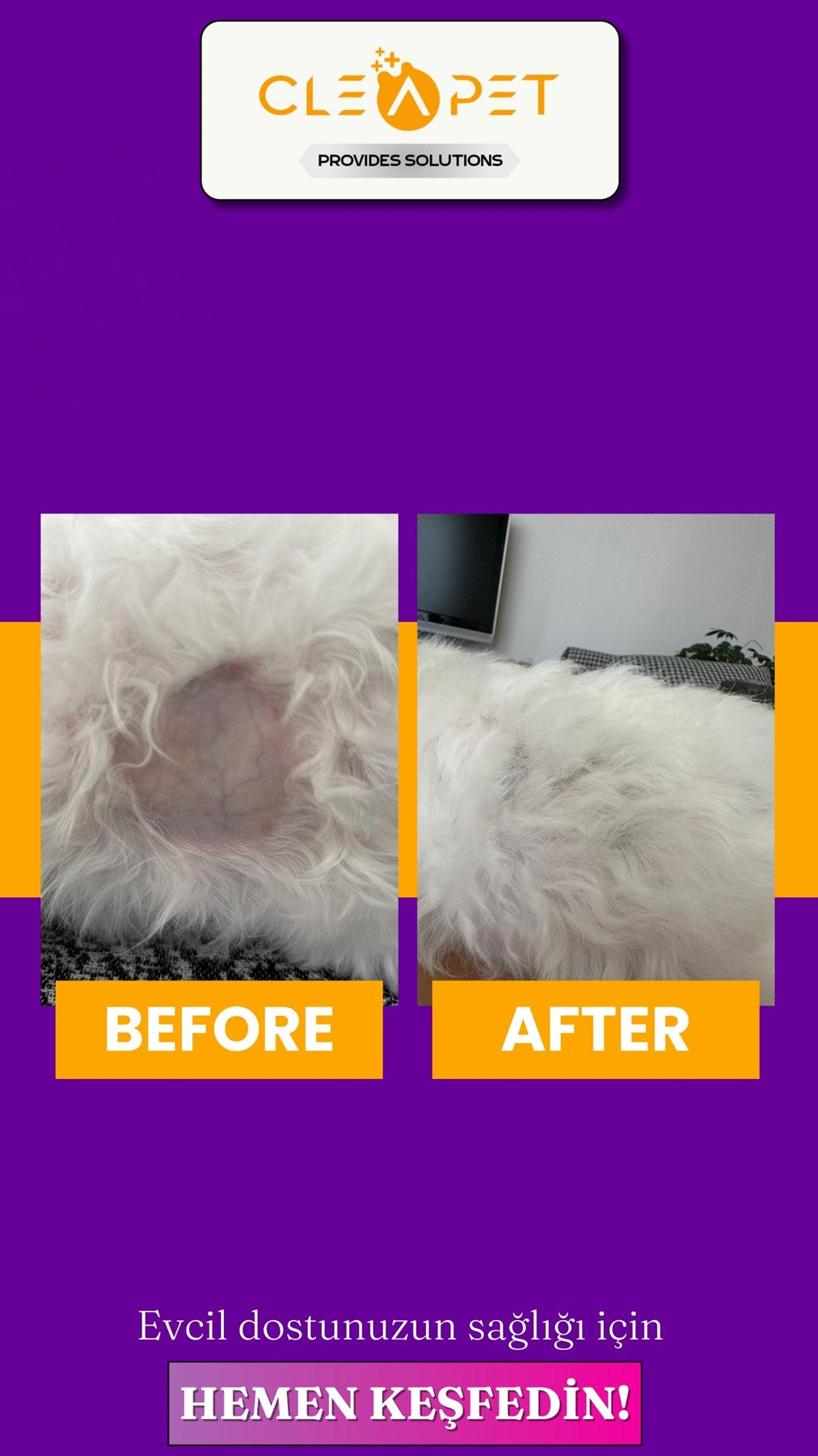 ALOPESİ X TEDAVİ SETİ