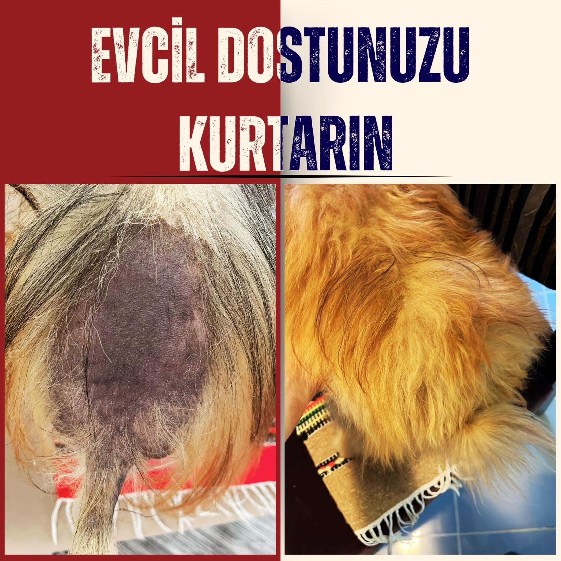 ALOPESİ X TEDAVİ SETİ