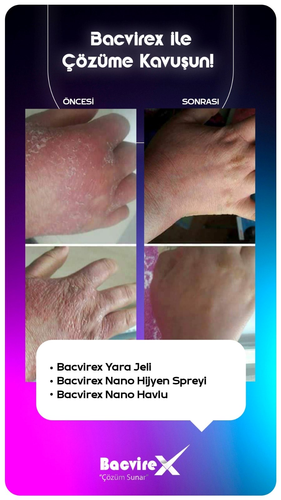 DERİ ONARIM JELİ İNSAN GRUBU 150ML